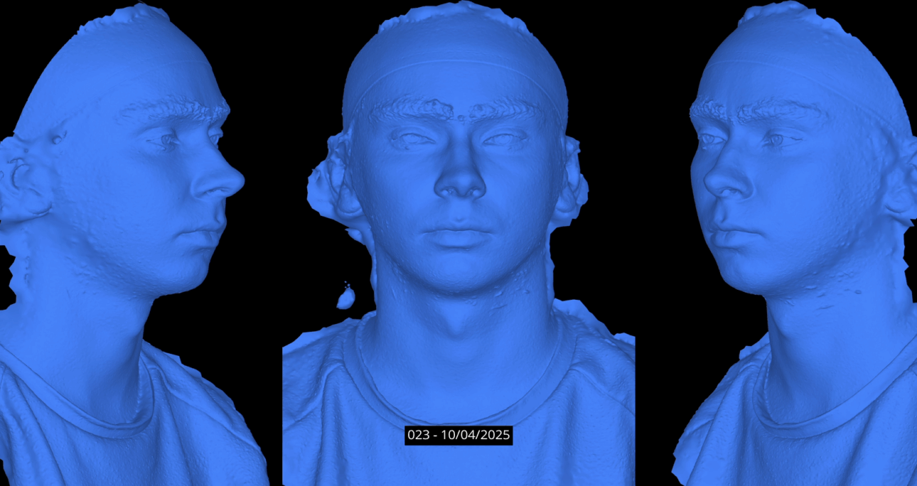 Capturing Facial Performances with a 4D Photogrammetry Rig