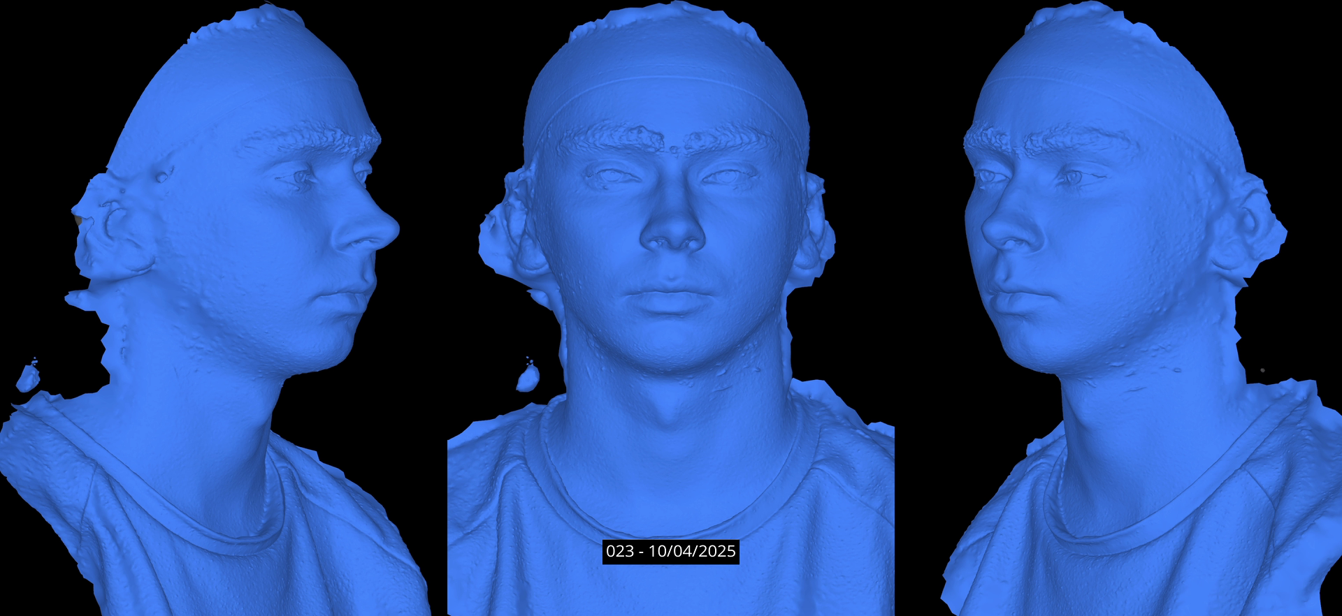 Capturing Facial Performances with a 4D Photogrammetry Rig